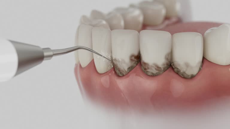 Reliable Dental contractor in Belleair Bluffs, FL by Dentist Open Now